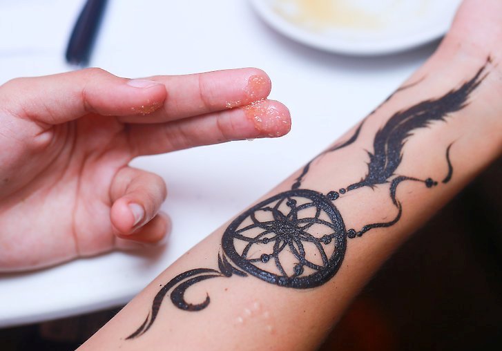 2. Understanding the Causes of Peeling Tattoos - wide 8